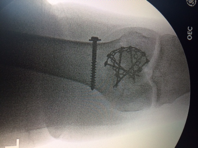 Larry Nipon
