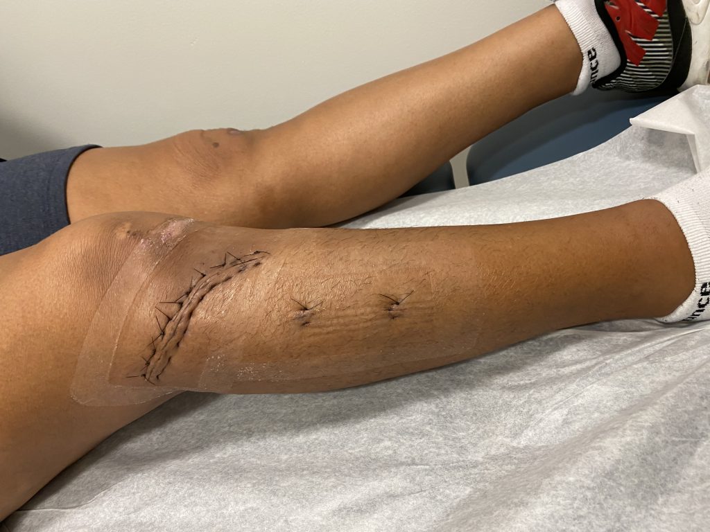 Patient image of: Leslie Colon