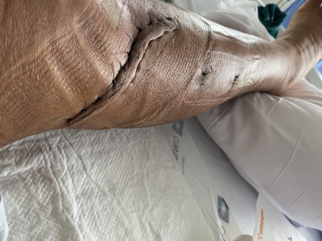 Patient image of: Leslie Colon