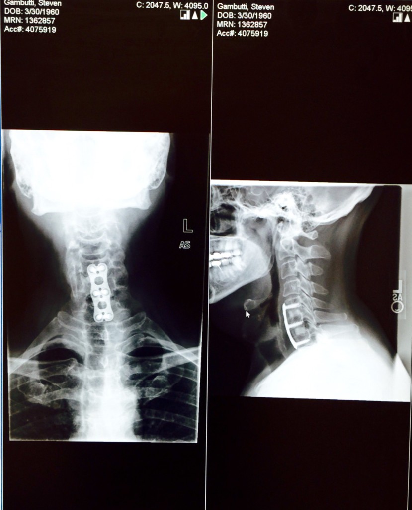 Patient image of: Steve Gambutti