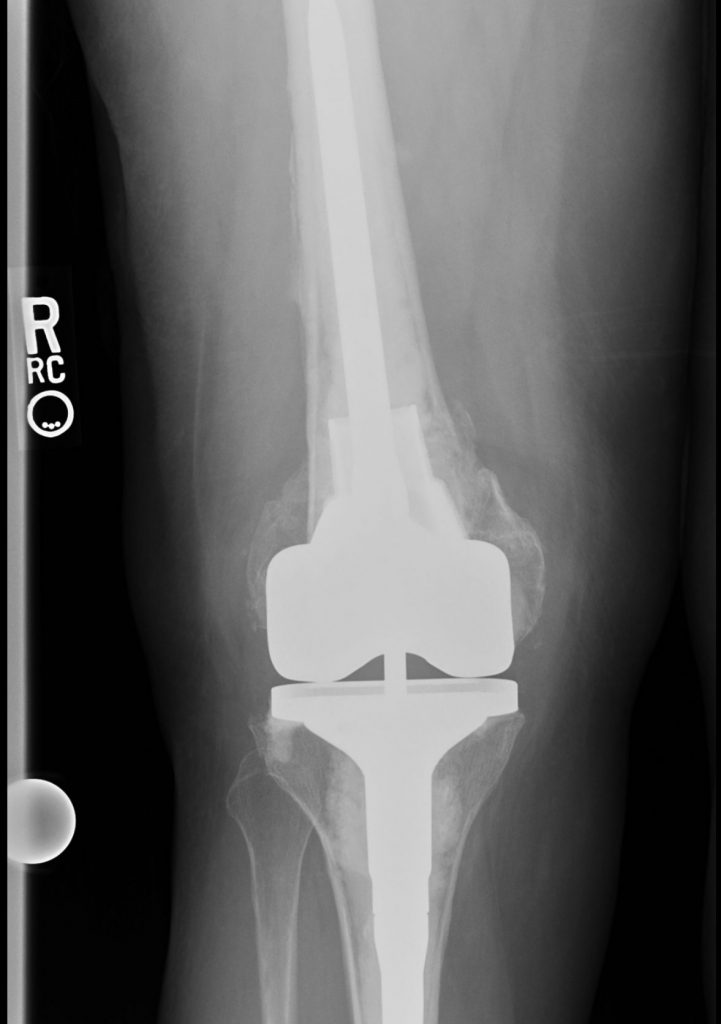 Patient image of: Carol Kramer