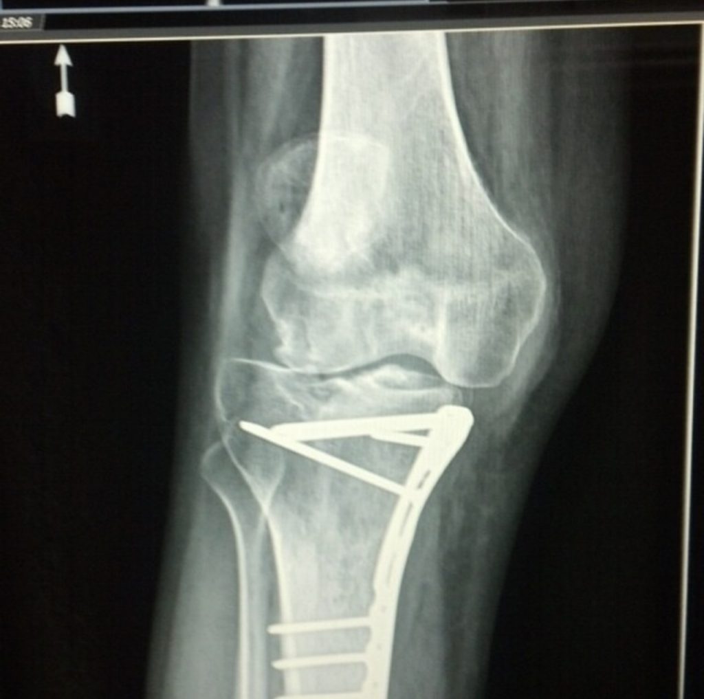 Patient image of: Andrew Pate