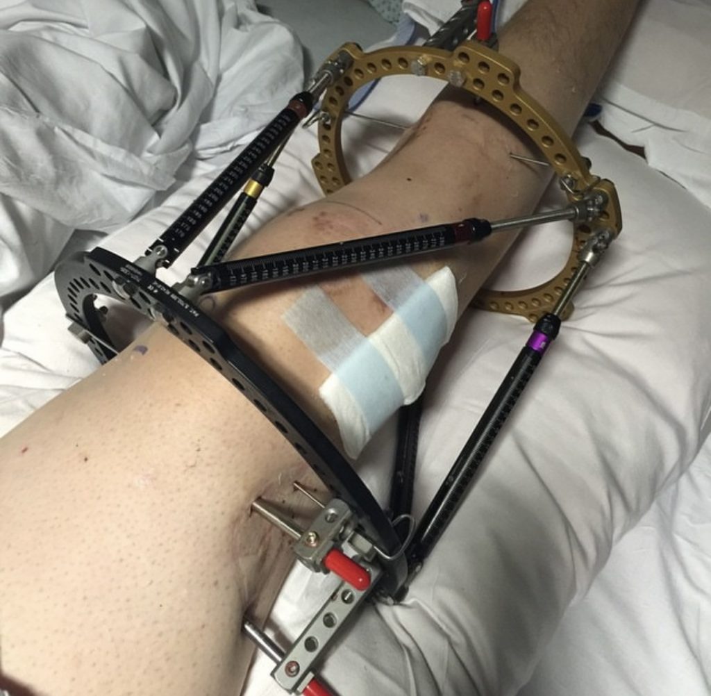 Patient image of: Andrew Pate