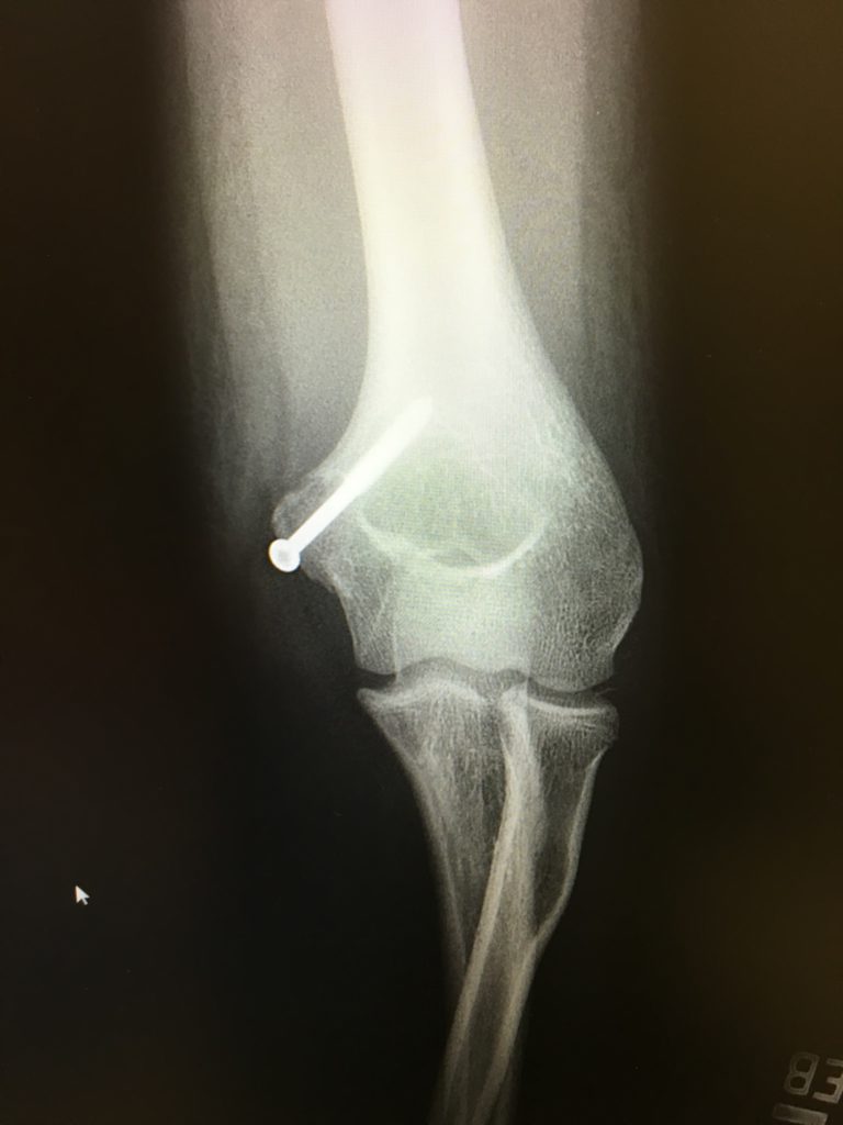 Patient image of: Emmy Sammons
