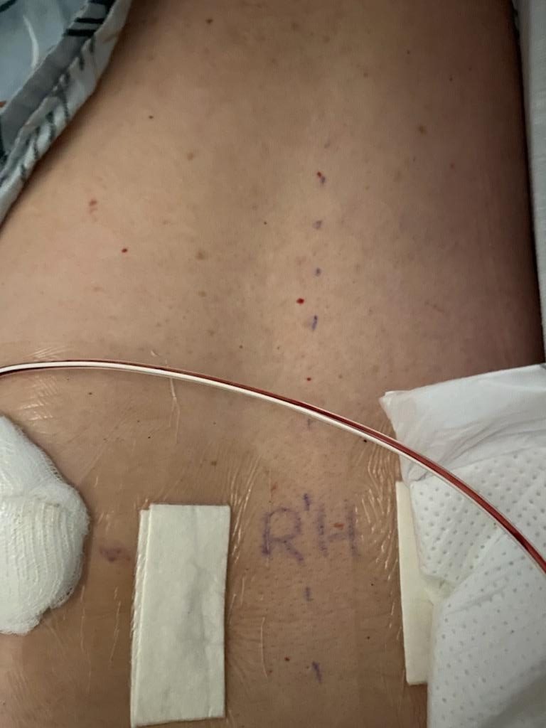 Patient image of: Becca Ironside