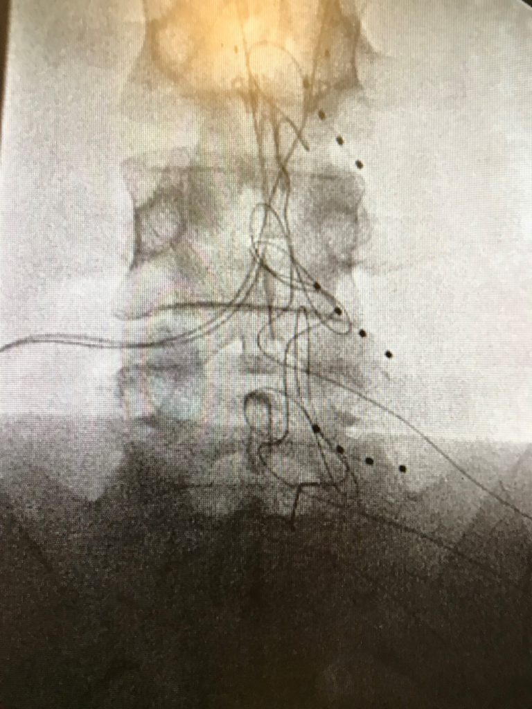 Patient image of: Brittany L.