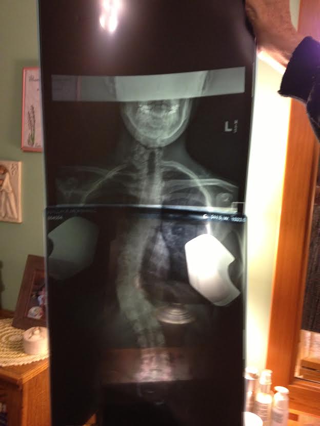 Patient image of: Meaghan Wallace