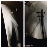 Patient image of: Robert Casale