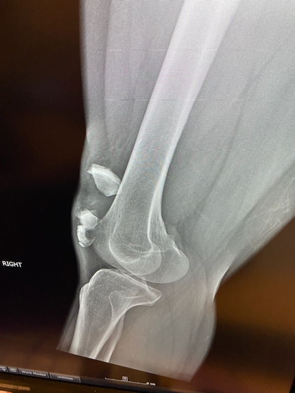 Patient image of: Amanda Knight