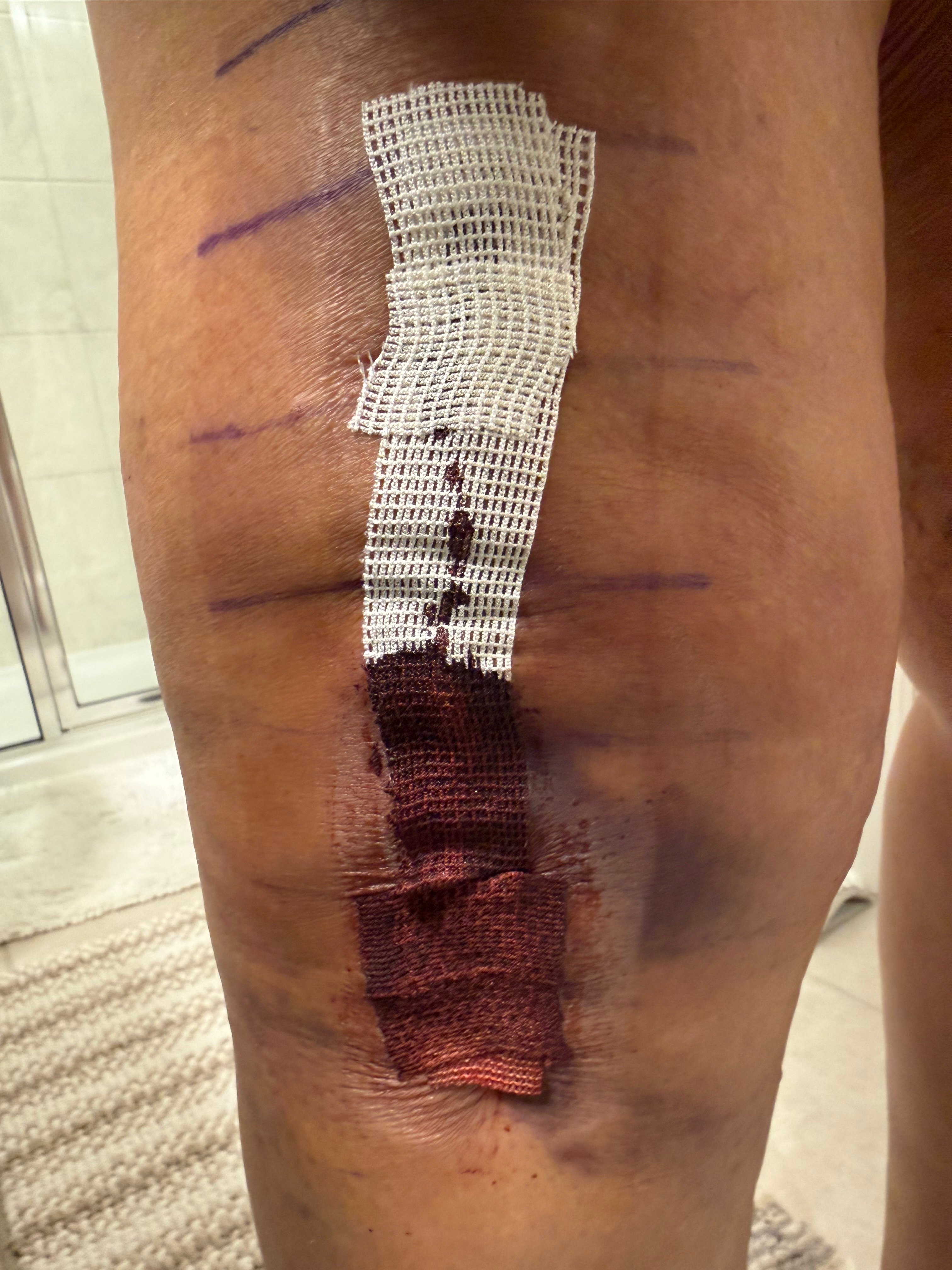 Patient image of: Roslyn Robinson