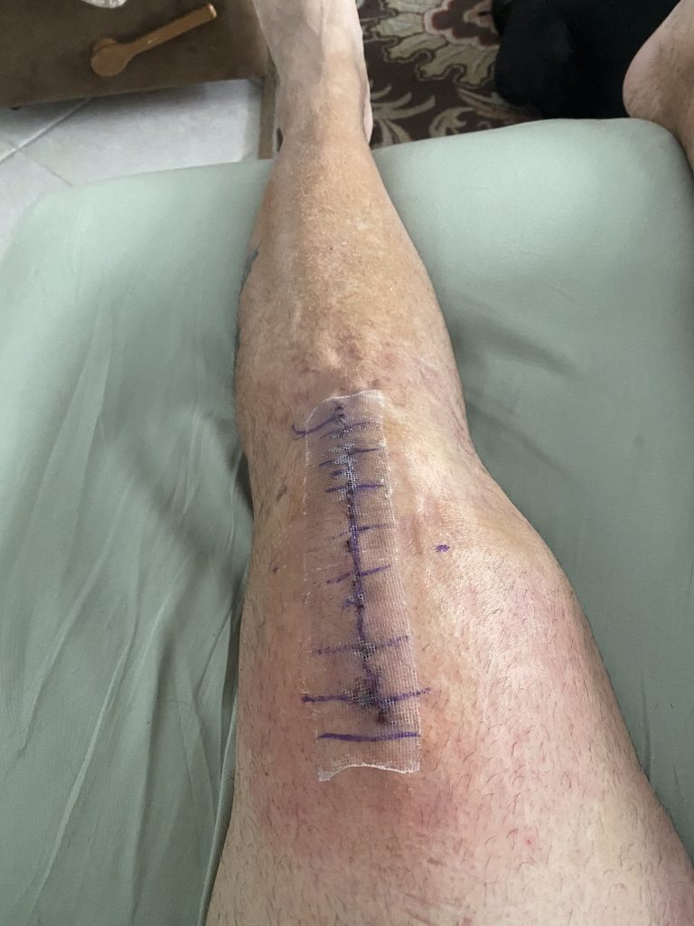 Patient image of: Rob Levy