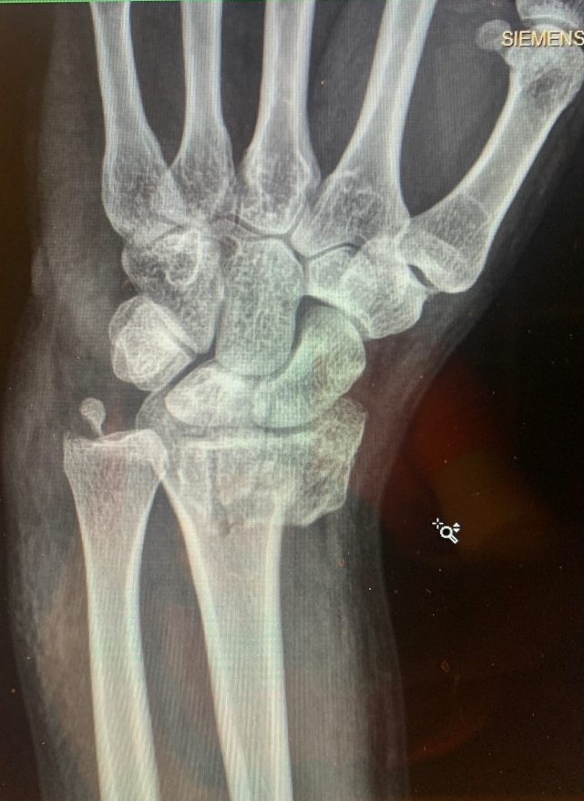 Patient image of: Jeffrey Frankel