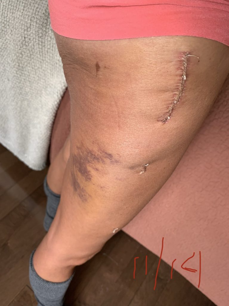 Patient image of: Abigail Stellpflug