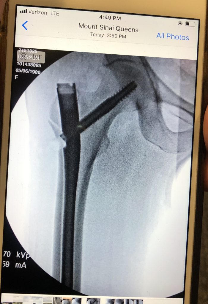 Patient image of: Abigail Stellpflug