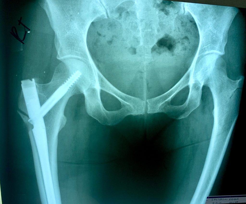 Patient image of: Abigail Stellpflug