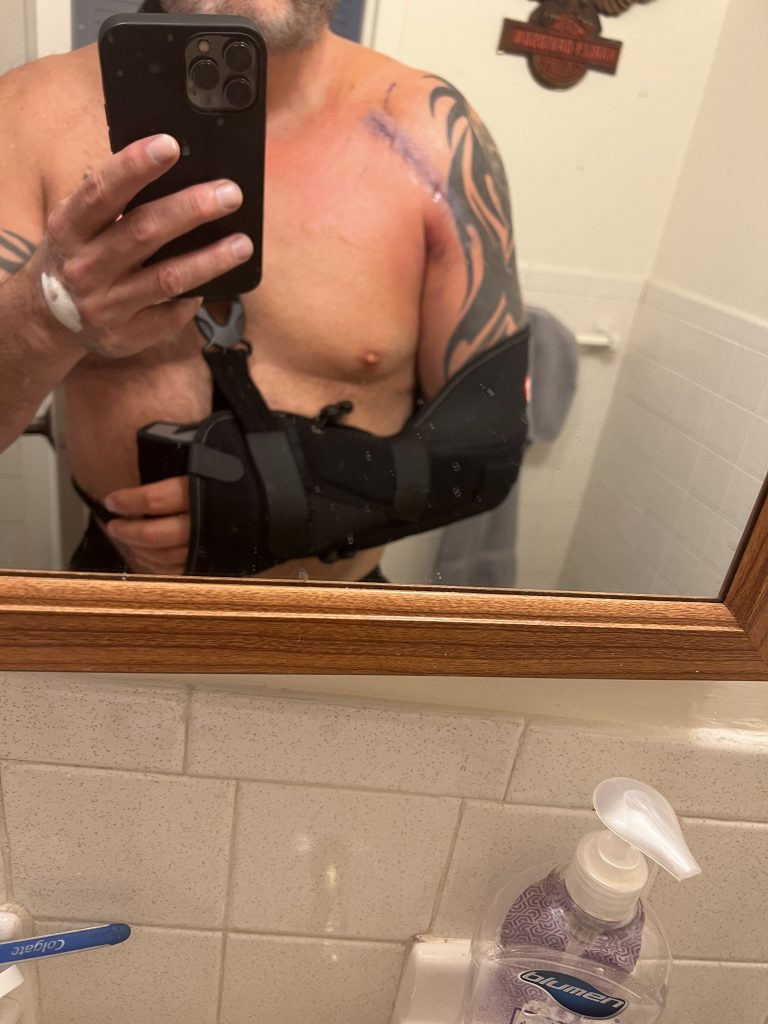 Patient image of: Lee Yaccarino