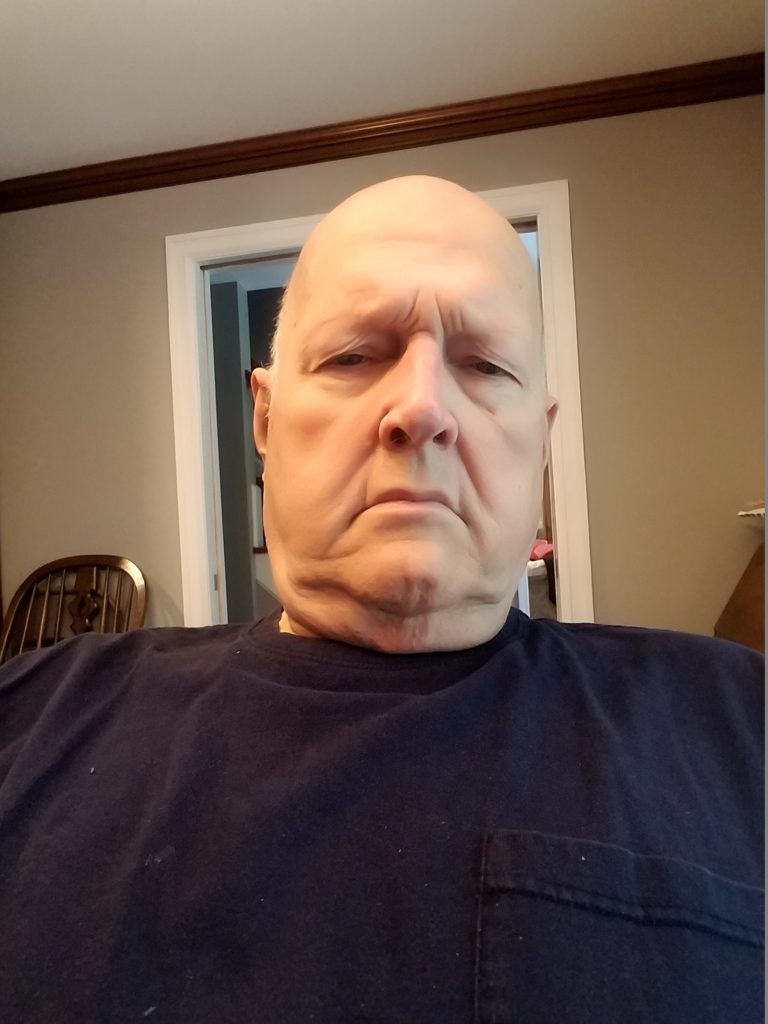 Patient image of: Daniel Hoyt