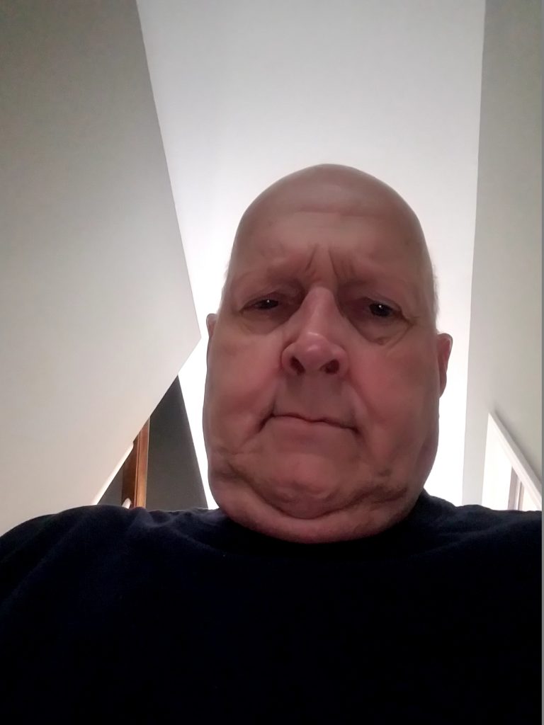Patient image of: Daniel Hoyt