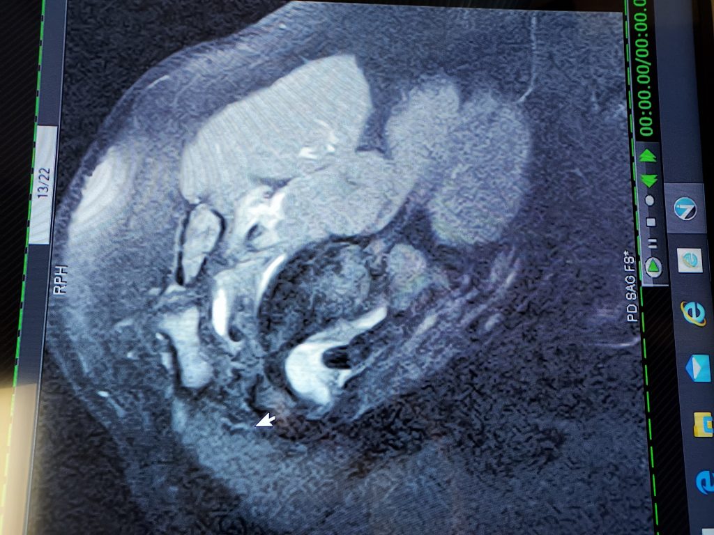 Patient image of: Salvatore Burriesci