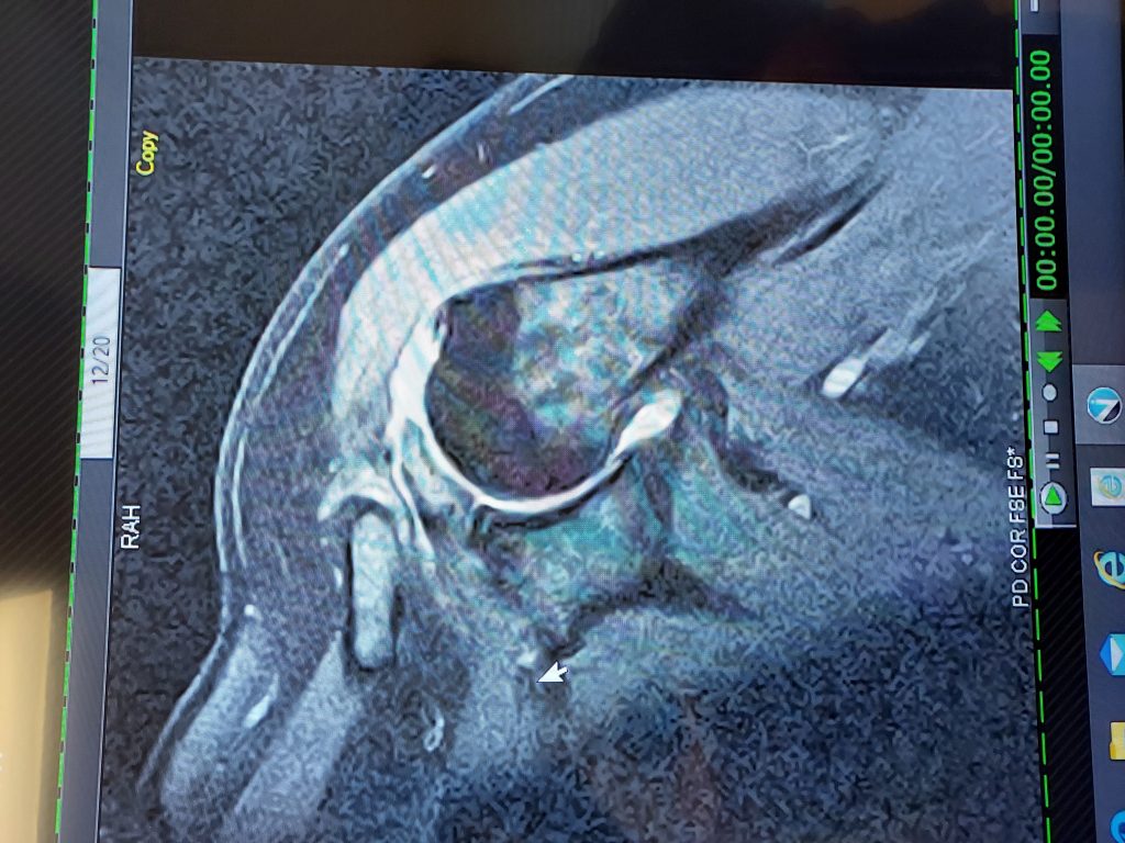 Patient image of: Salvatore Burriesci