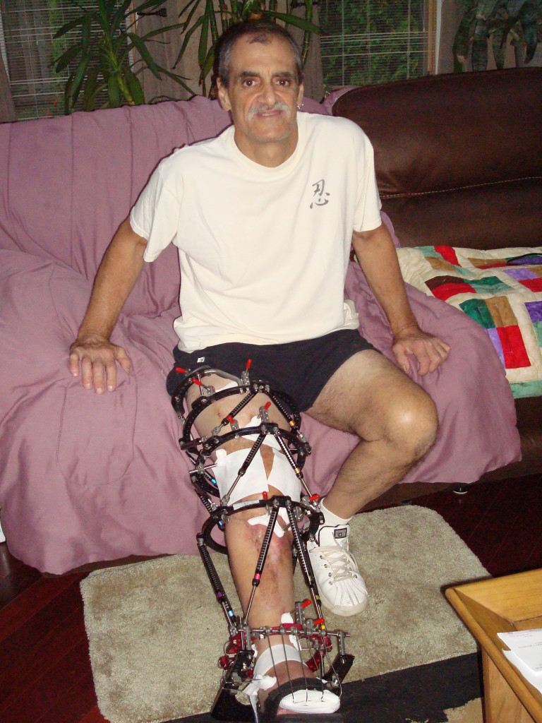 Patient image of: Ron Pollicino