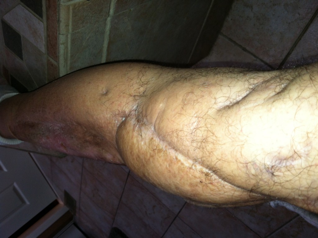 Patient image of: Ron Pollicino