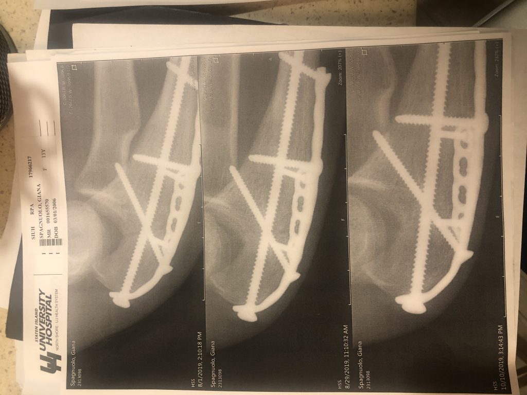 Patient image of: Giana Spagnuolo