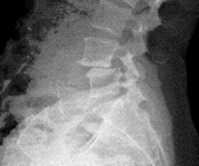 Patient image of: Samantha Liebman Elbaum
