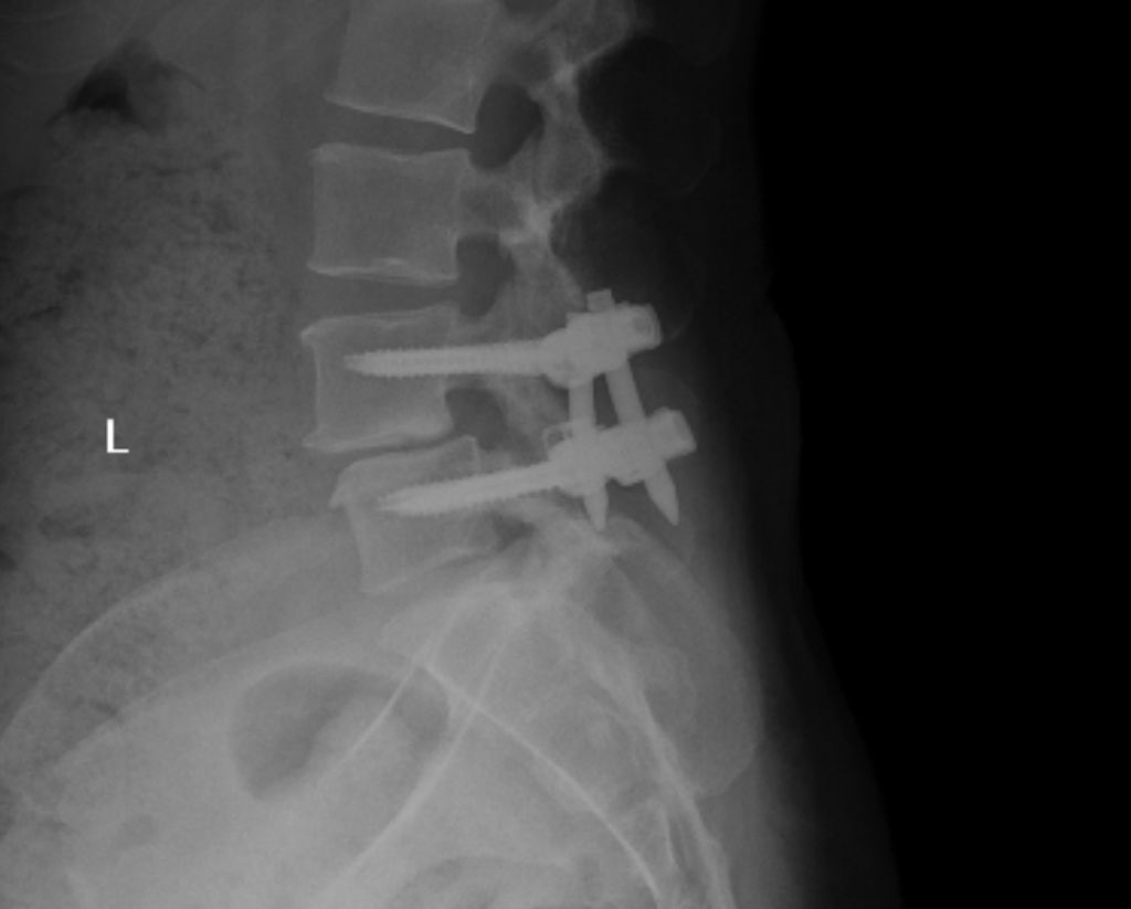 Patient image of: Samantha Liebman Elbaum