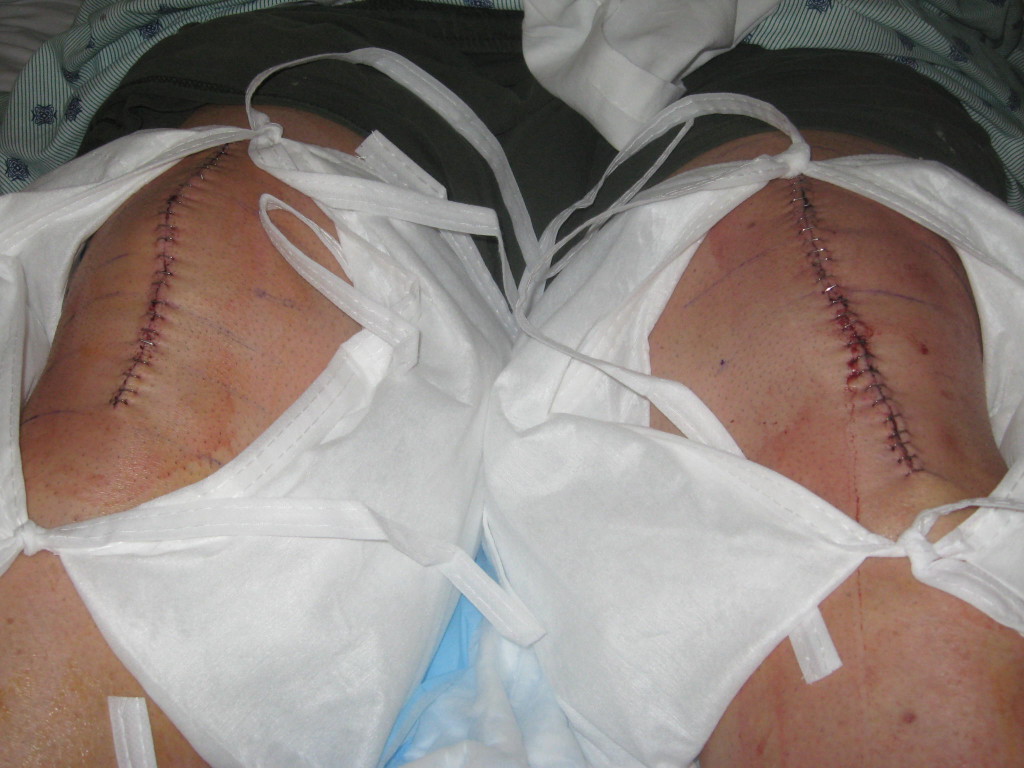 Patient image of: Larry Farina