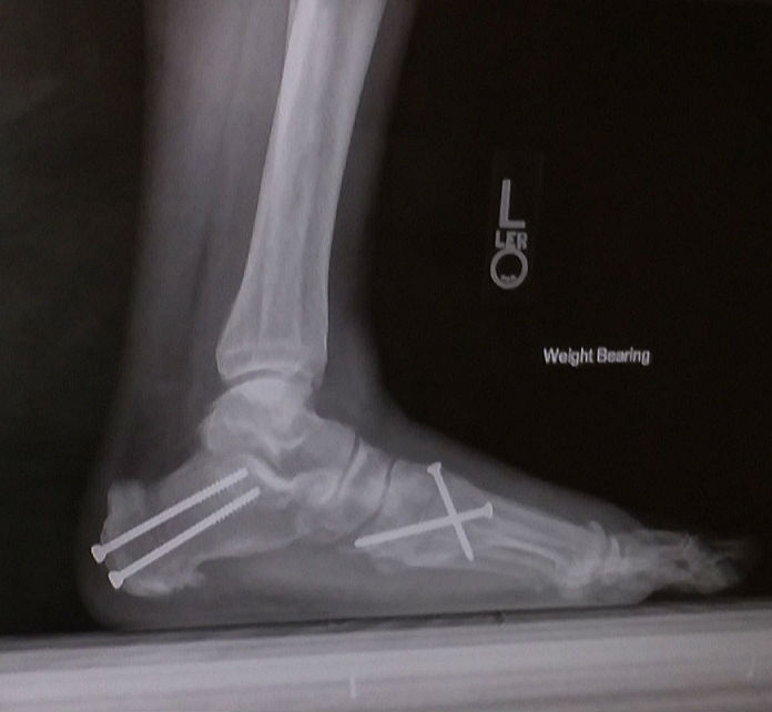 Patient image of: Bob Sauer