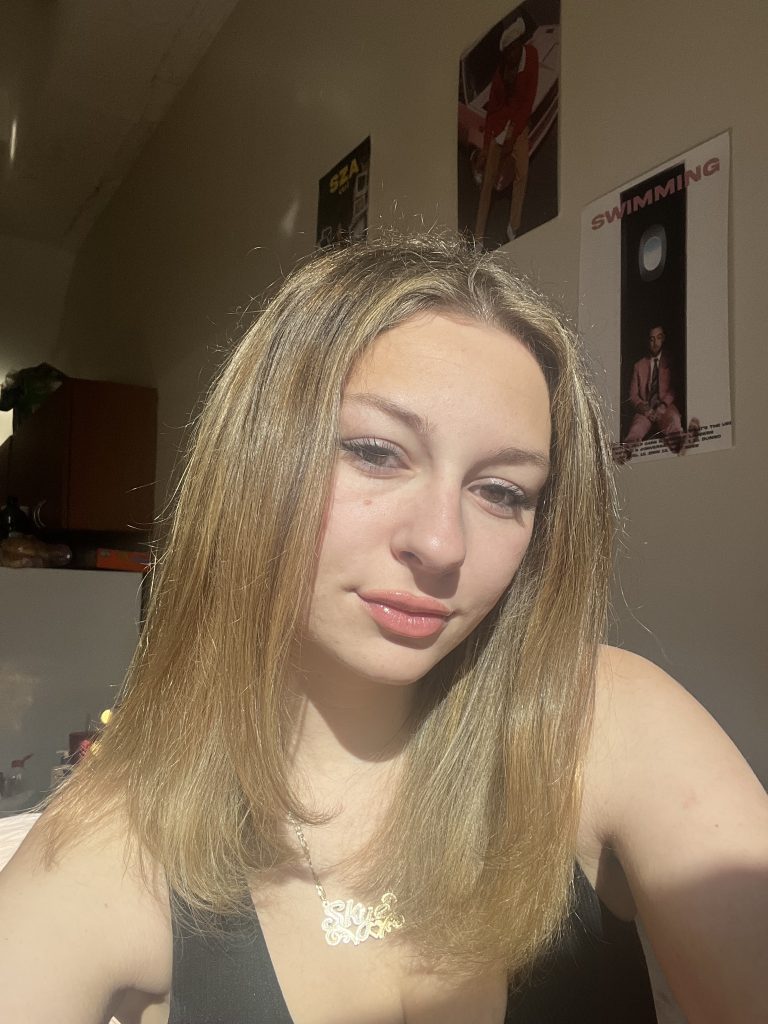 Patient image of: Skylar Wolfson
