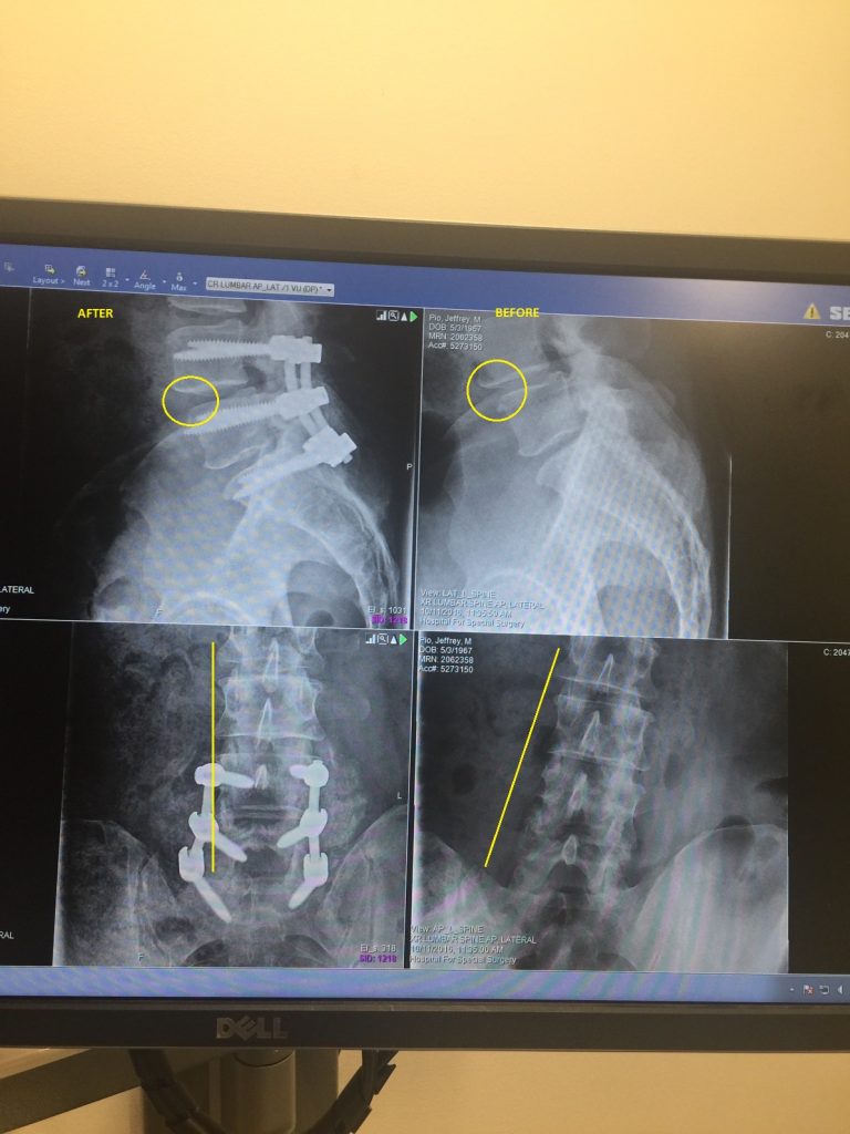 Patient image of: Jeff Pio