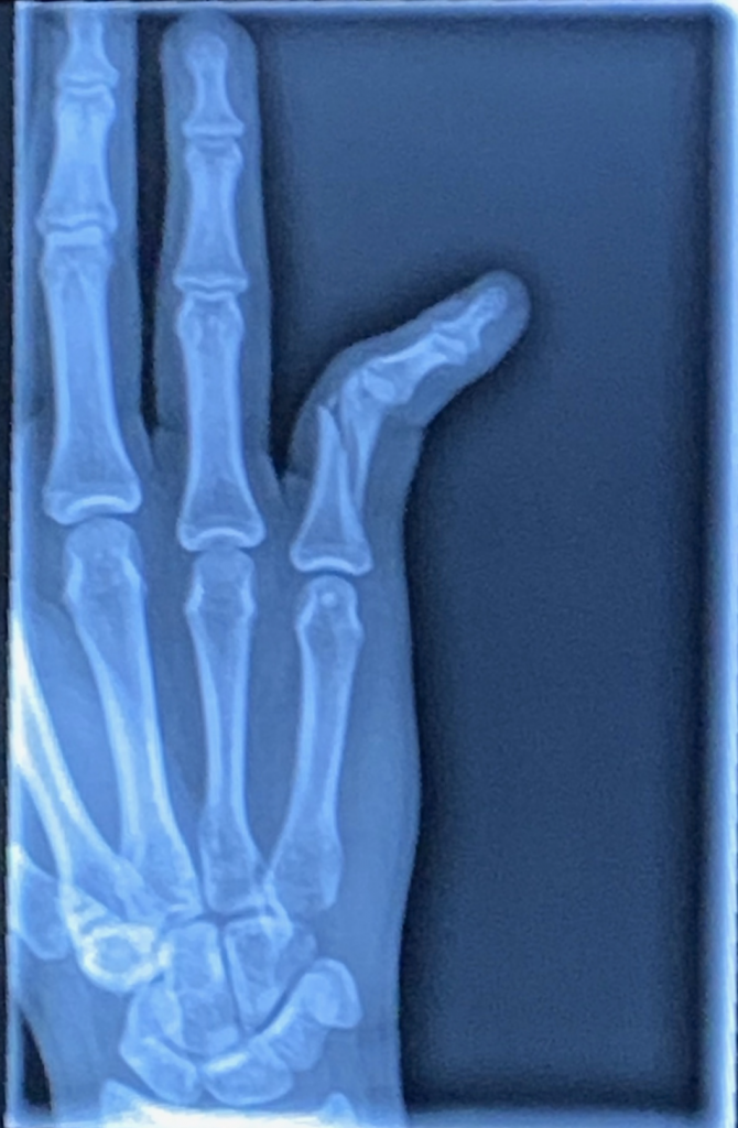 Patient image of: Sarina Chitkara