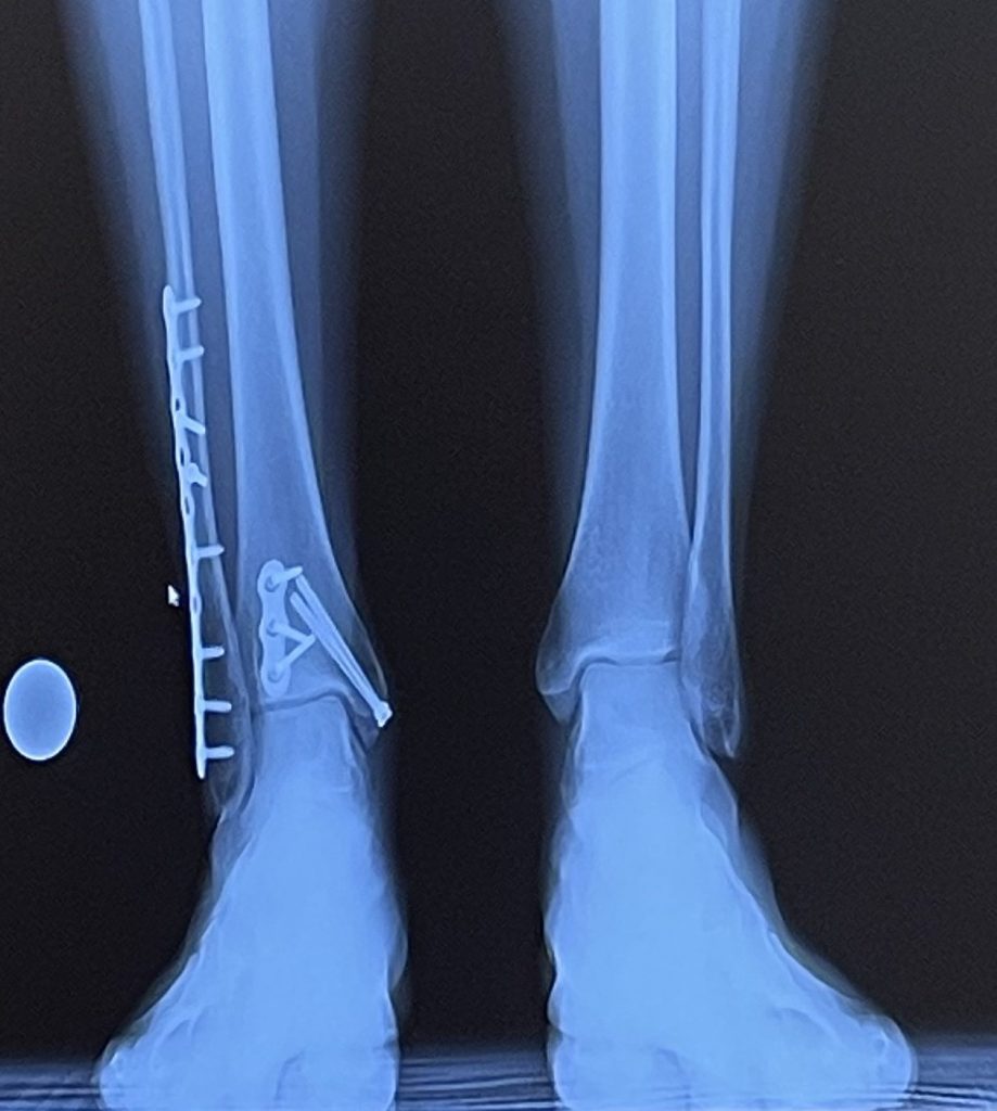 Patient image of: Emeline Mastrianni