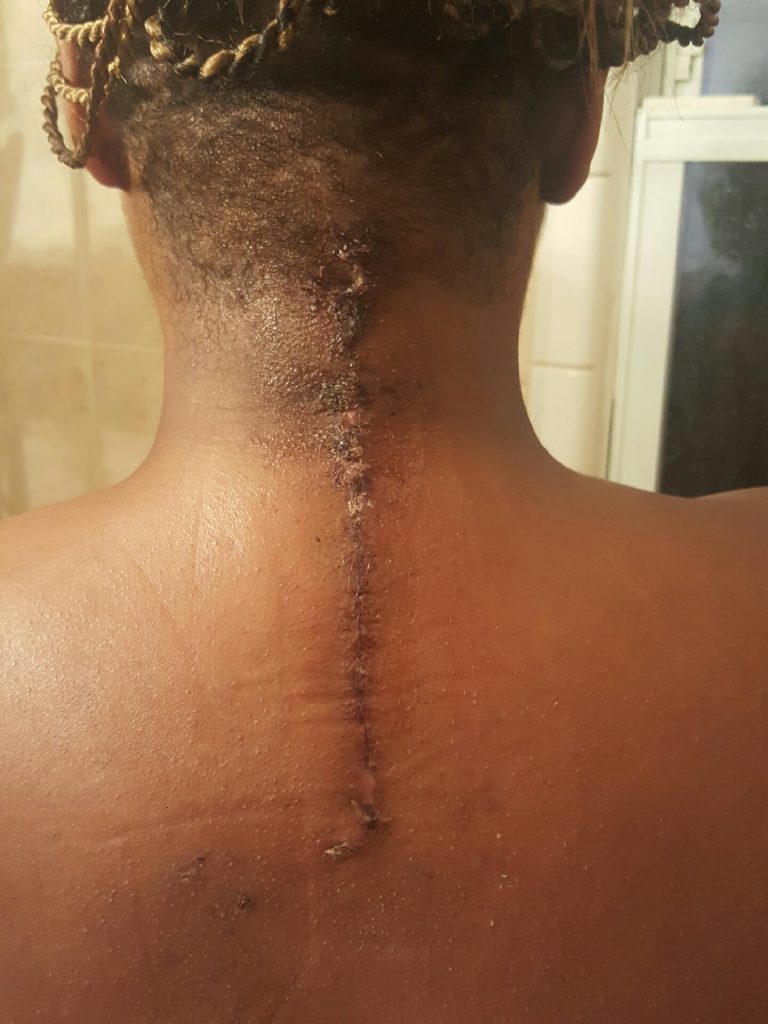 Patient image of: Nikki Cesar