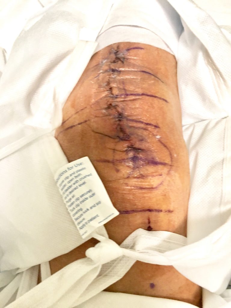 Patient image of: L. E.