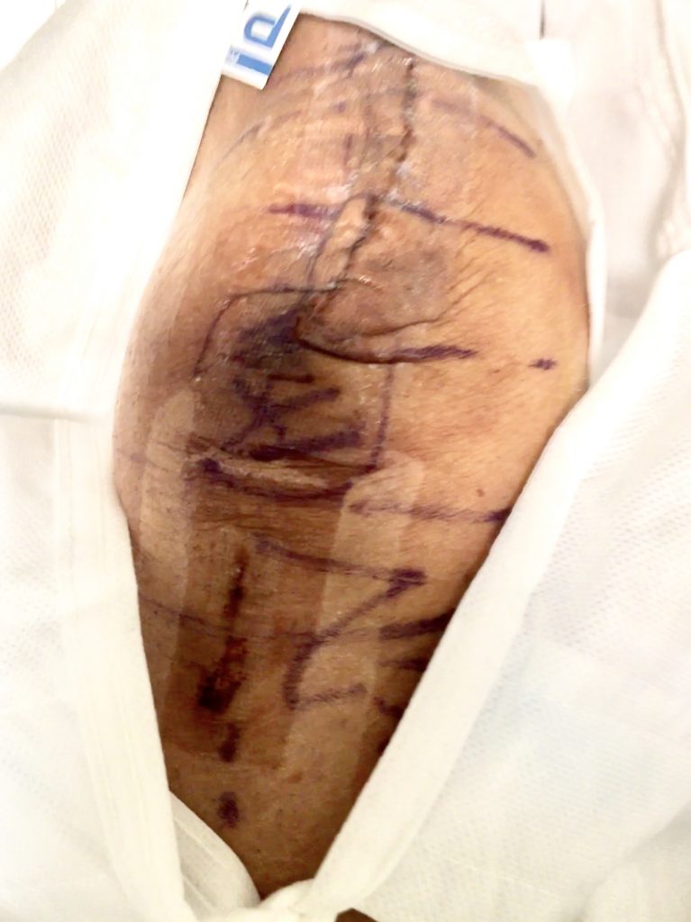 Patient image of: L. E.