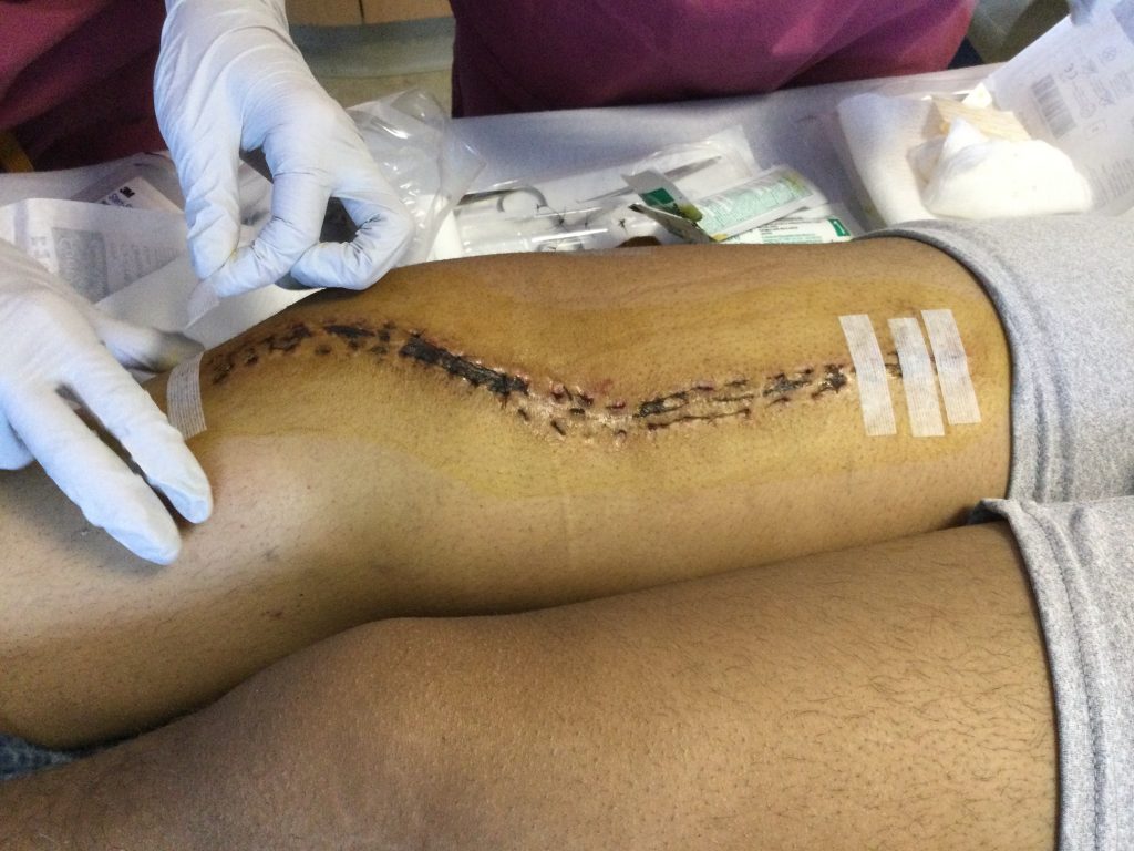 Patient image of: James Cobo