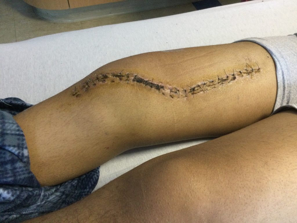 Patient image of: James Cobo
