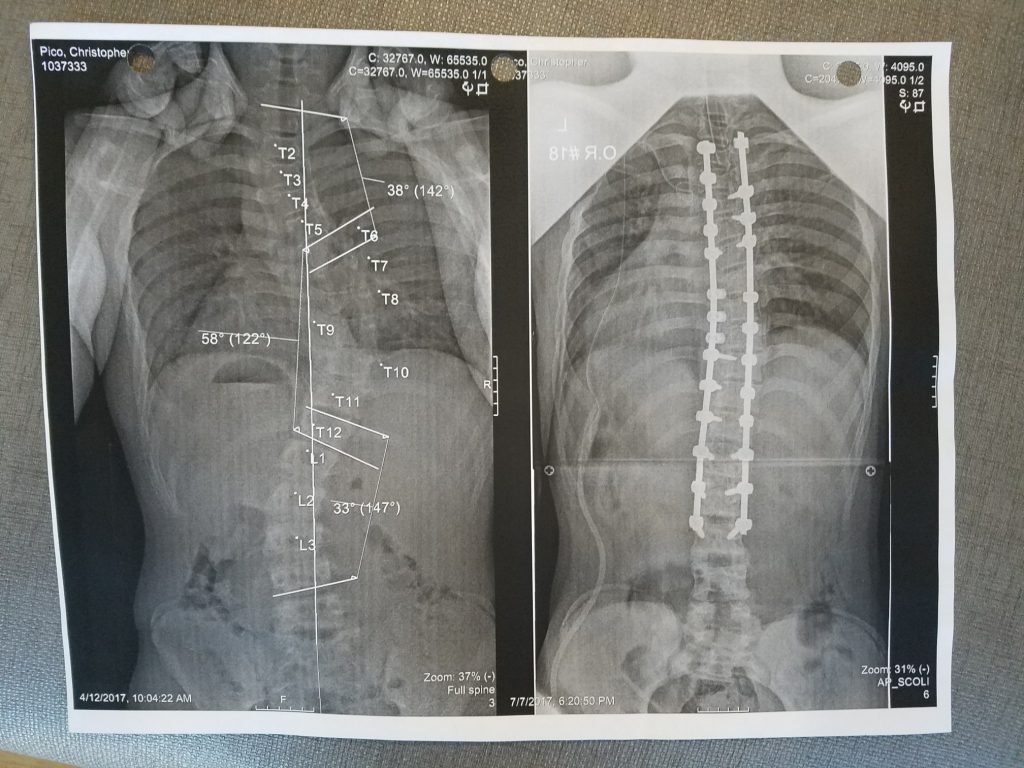 Patient image of: Chris Pico
