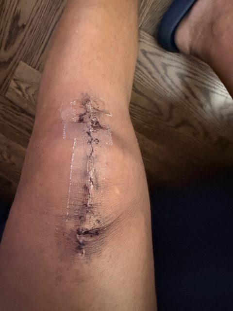 Patient image of: Kenneth Morales
