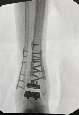 Patient image of: Kevin McNeilly