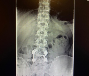 Patient image of: Michael Thomas