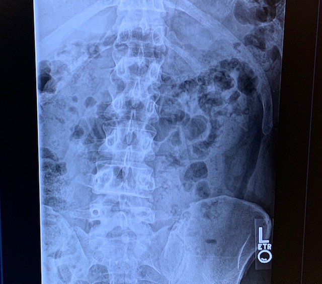 Patient image of: Michael Thomas