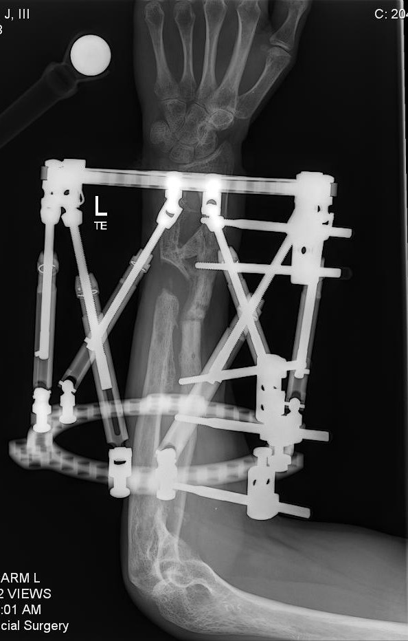 Patient image of: Henry Daniecki