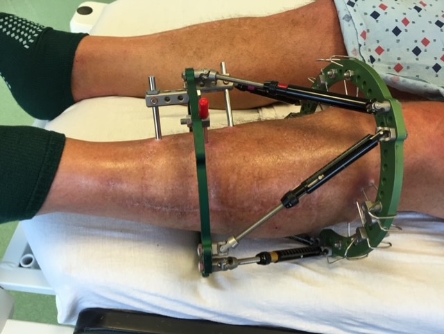 Patient image of: Steven O'Riley