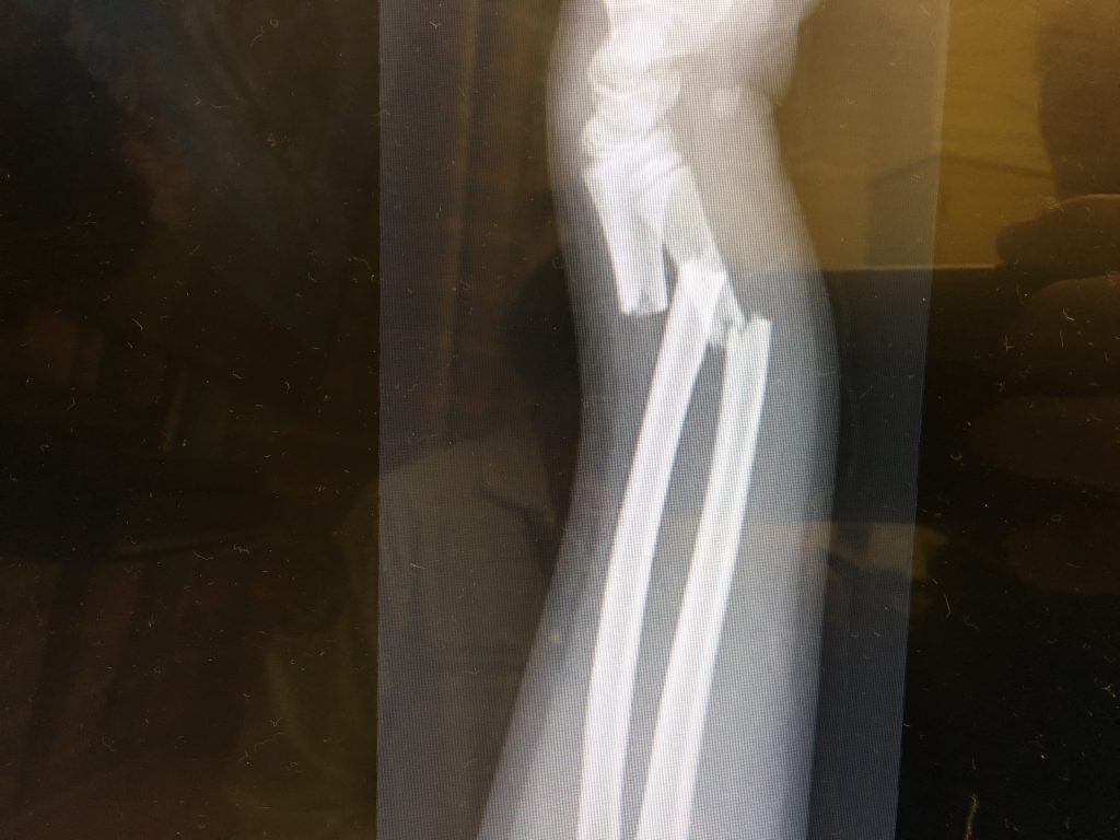 Patient image of: Benjamin Trachtman