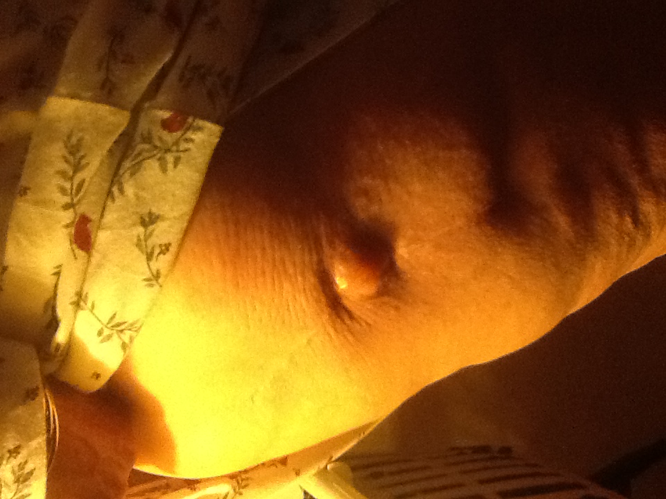 Patient image of: Cherryl Jost
