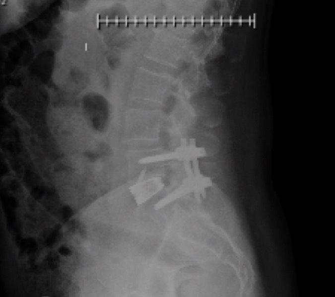 Patient image of: Nancy Kohlhoff